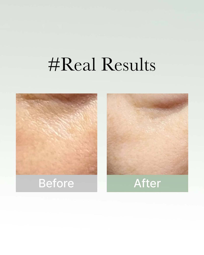 Holy Hyssop Serum 30