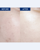 YULMU  Brightening Spot Cream