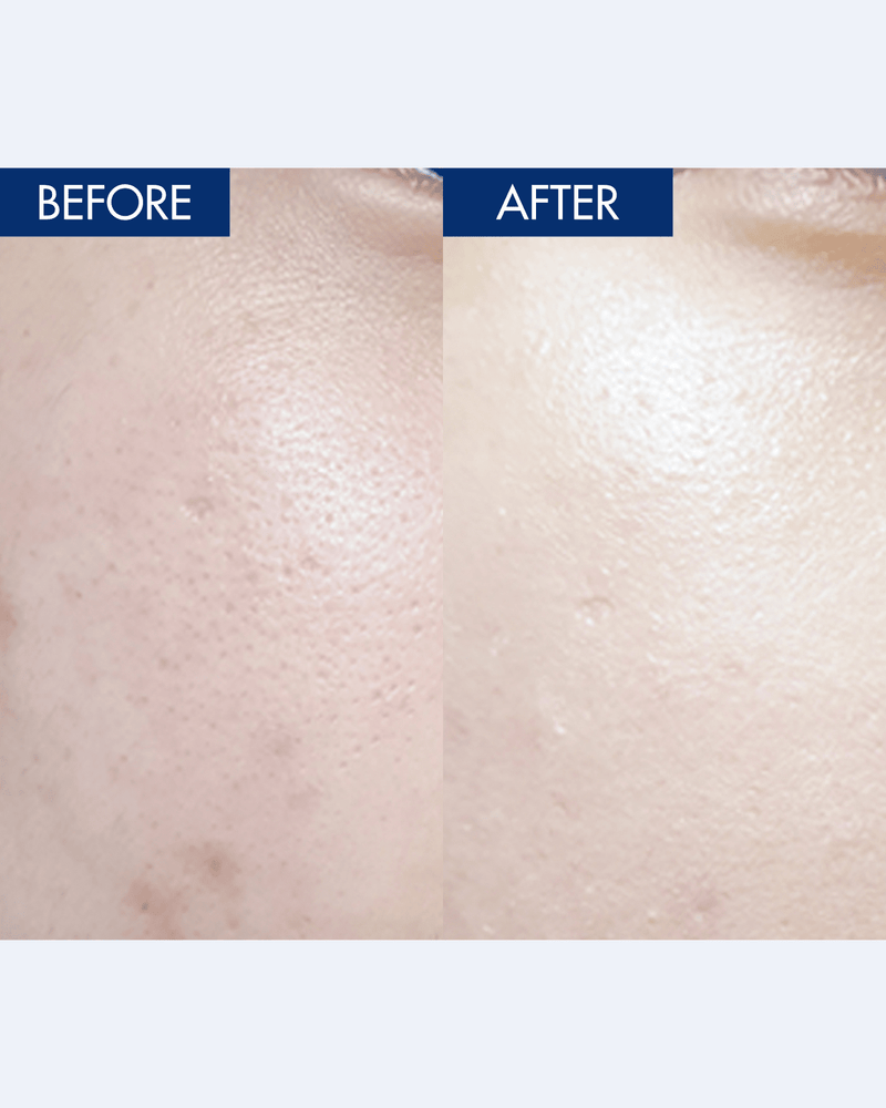 YULMU  Brightening Spot Cream