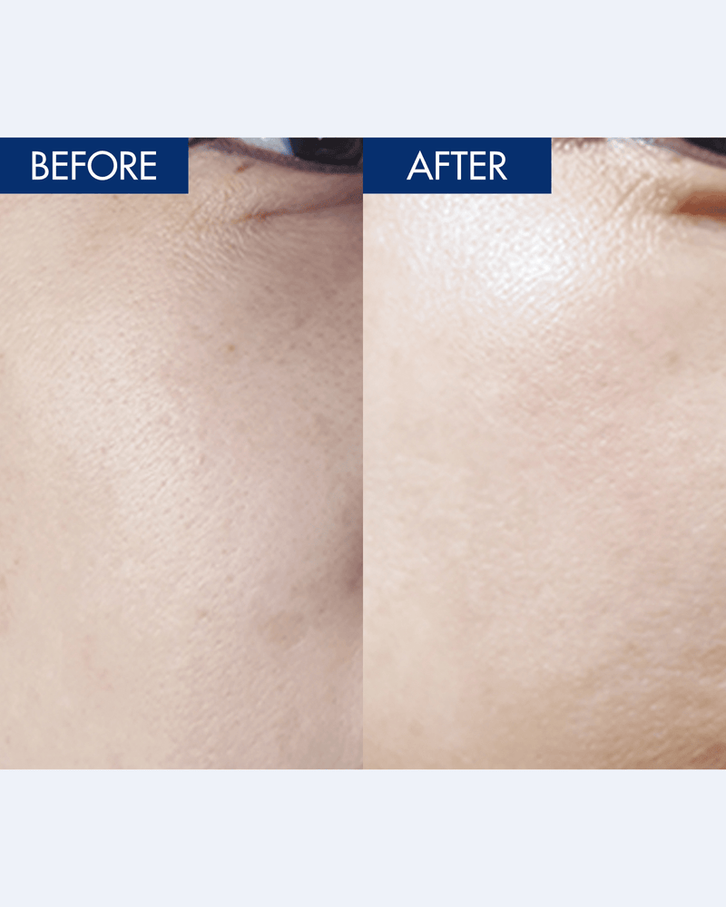 YULMU  Brightening Spot Cream